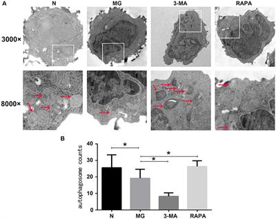 Effects of Mitophagy on Regulatory T Cell Function in Patients With Myasthenia Gravis